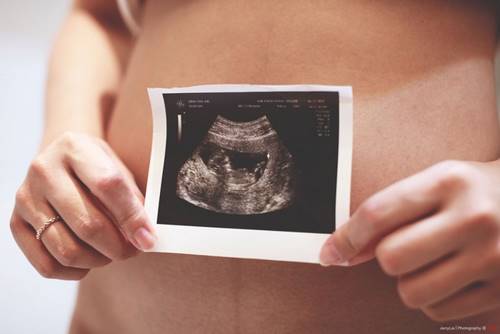 Странные, но правдивые факты о беременности. Такого ты точно не знал!