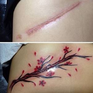 42 татуировки, которые превратили шрамы в произведение искусства.
