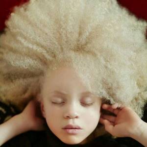 Этот нежный фотопроект об удивительных альбиносах заставит тебя по-другому взглянуть на «особенных».