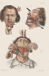 Как лечили людей в XIX веке. 12 иллюстраций, которые по-настоящему шокируют!