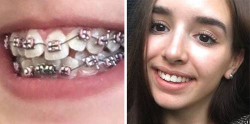 40 удивительных случаев, когда стоматологи творили чудеса.