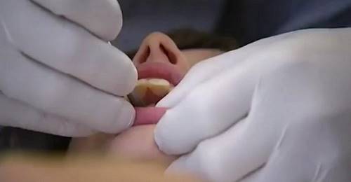 40 удивительных случаев, когда стоматологи творили чудеса.