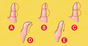 Вот как твой характер зависит от формы большого пальца